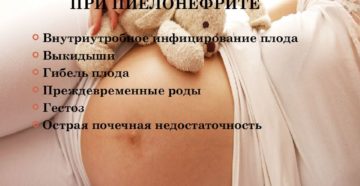 Можно ли беременеть при пиелонефрите