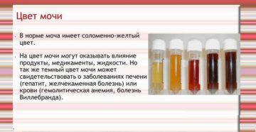 Моча цвета чая почему