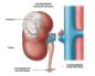 Нефрэктомия почки послеоперационный период диета