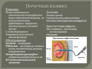 Мочекаменная болезнь почечная колика слева