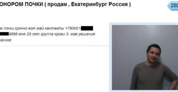 Как стать донором почки за деньги в москве