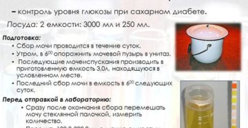 Почему анализ мочи сдают утром