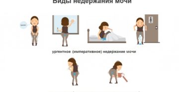 Как называется болезнь когда недержание мочи
