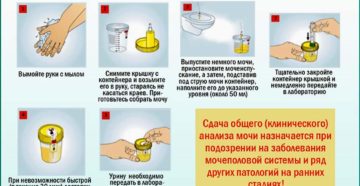 Как правильно собрать мочу на общий анализ беременной