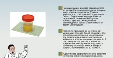 Обязательно ли мочу сдавать натощак