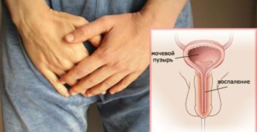 Боль в головке члена при мочеиспускании