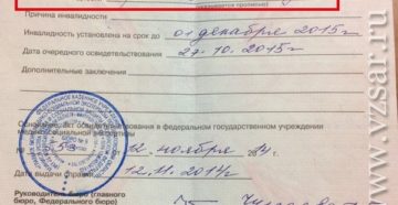 Если одна почка дадут ли инвалидность