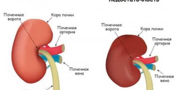 Нормальная работа почек