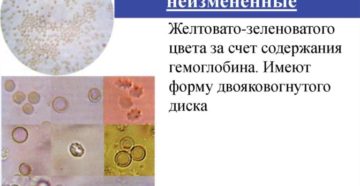 Выщелоченные эритроциты в моче причины