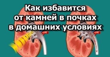 Как вылечить почки в домашних условиях от камней