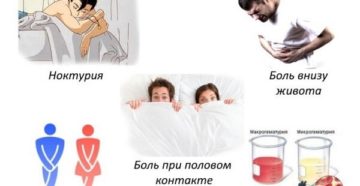 Болит низ живота и хочется в туалет по маленькому