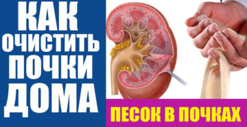 Как очистить песок из почек