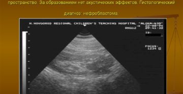 В верхнем полюсе левой почки объемное образование