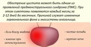 Частое мочеиспускание при месячных причины