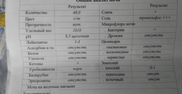 Запах мочи у ребенка 2 лет
