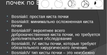 Кисты почек босниак