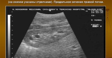 Что такое повышенная эхогенность в почках