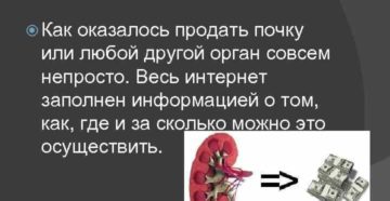Как продать почку в крыму