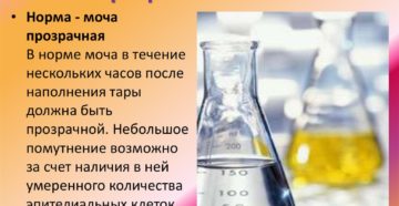 Что означает если прозрачная моча