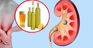 Как быстро избавиться от боли в почках