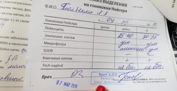 Исследование выделений у женщин расшифровка