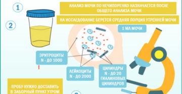 Анализ мочи по нечипоренко сколько делается по времени