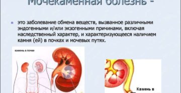 Мочекаменная болезнь у мужчин обострение