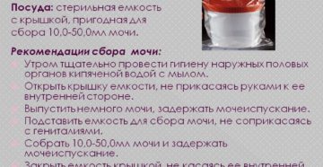 Как правильно сдать анализ мочи на посев женщине