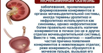 Цистит и мочекаменная болезнь