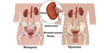 Пиелонефрит почек симптомы у мужчин