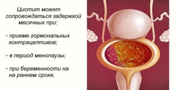 Цистит до задержки месячных