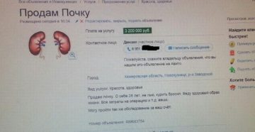 Можно ли в красноярске продать почку