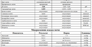 У ребенка в моче повышенное содержание соли в моче
