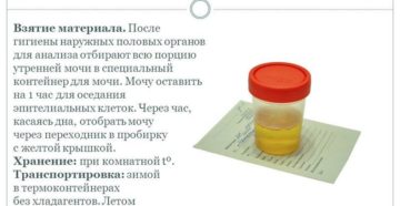 Сколько времени можно хранить мочу для анализа