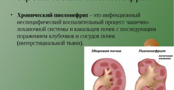 Неспецифические структурные изменения в почках что это