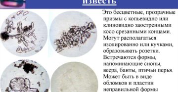 В моче фосфорнокислая известь