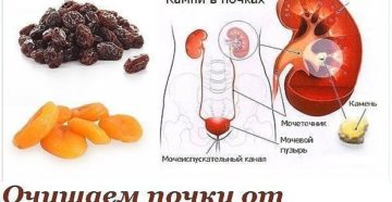 Что пить от песка в почках