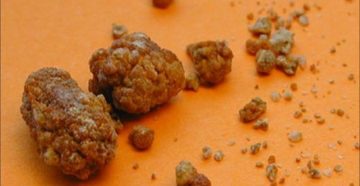 От каких продуктов образуется песок в почках