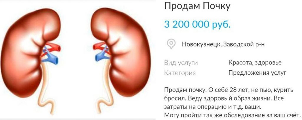 По чем можно продать почку