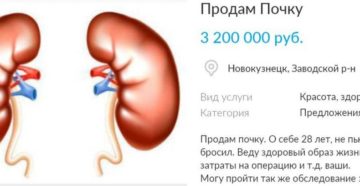 По чем можно продать почку