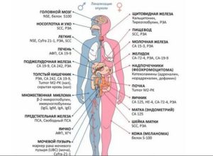 Онкомаркеры почек какие