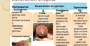 Белые выделения жжение при мочеиспускании у мужчин