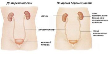 Мочевой пузырь и беременность