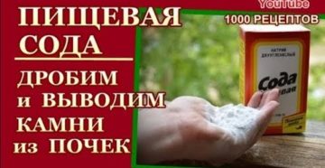 Лечение камней почек содой
