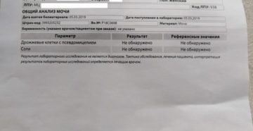 Общий анализ мочи смд