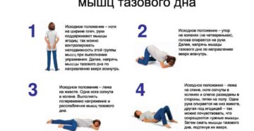 После инсульта недержание мочи можно ли вылечить