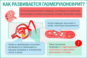 Может быть температура при заболевании почек