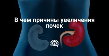 Если одна почка увеличена у взрослого