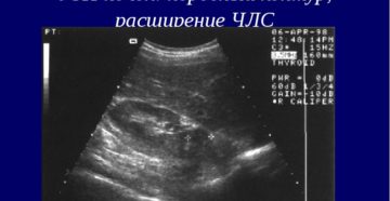 Узи почек при беременности члс расширена