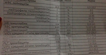 Сколько готовится анализ мочи в поликлинике
